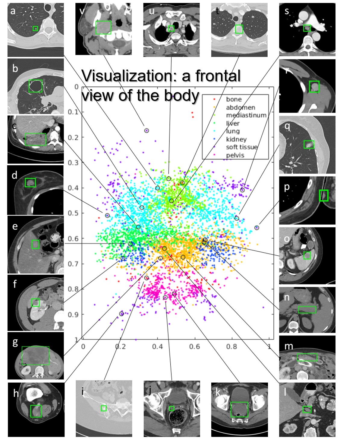 visualization of the DeepLesion dataset